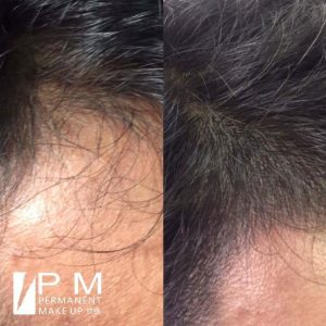 Kit de Pigmentos Capilar